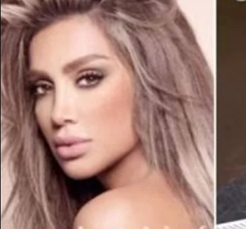 مايا دياب تغير شكلها "أنا تشوهت"